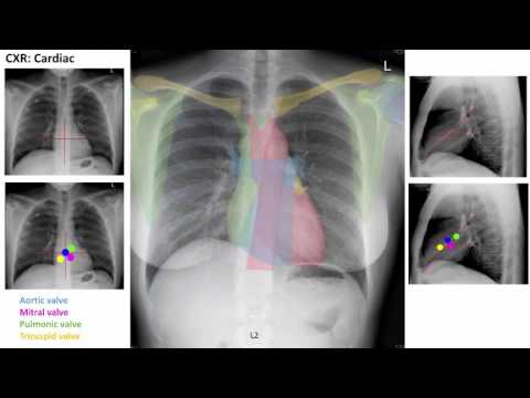 Anatomy of a Chest XRay