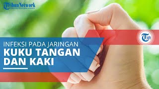 Paronikia, Infeksi Jaringan yang Terjadi pada Sekitar Kuku Jari-jari Tangan atau Kaki