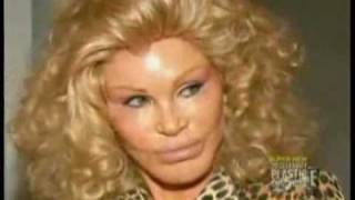 How Much Plastic Surgery did Cat Lady Jocelyn Wildenstein Have Done?