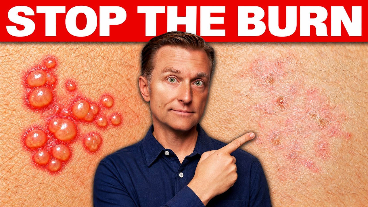 The Shingles Rash Is Gone but the Pain Isn’t (Here’s the Fix)
