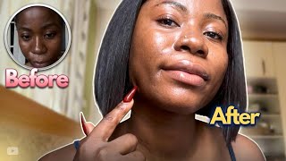 The 4-Step Skincare Routine That Changed My Skin