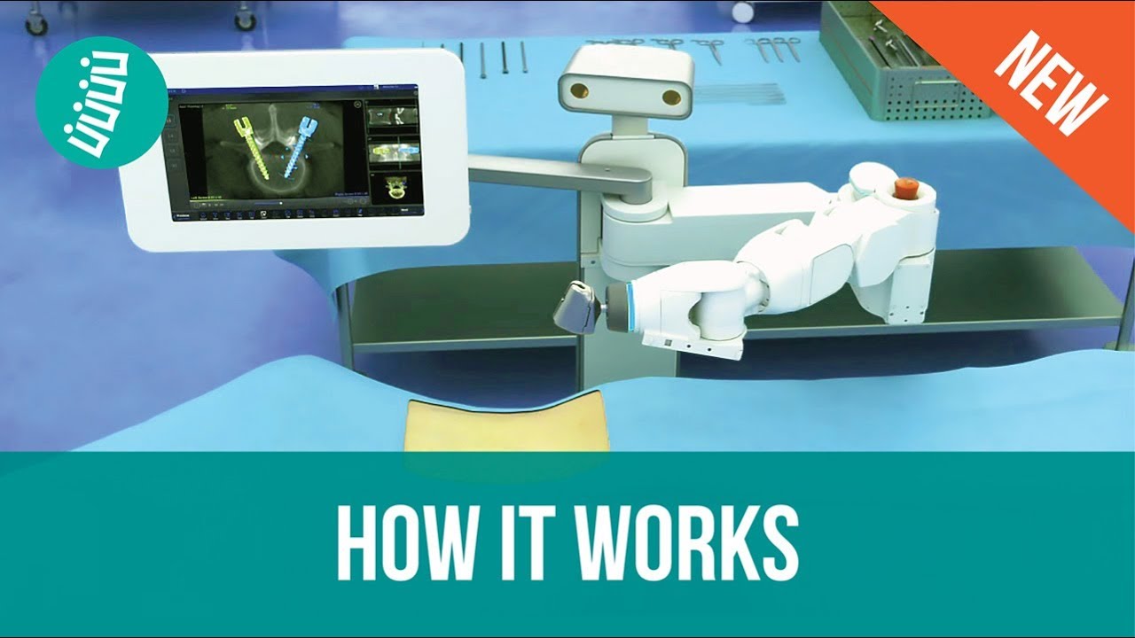 Mazor X - Robotic Assisted Spine Surgery (How it Works)
