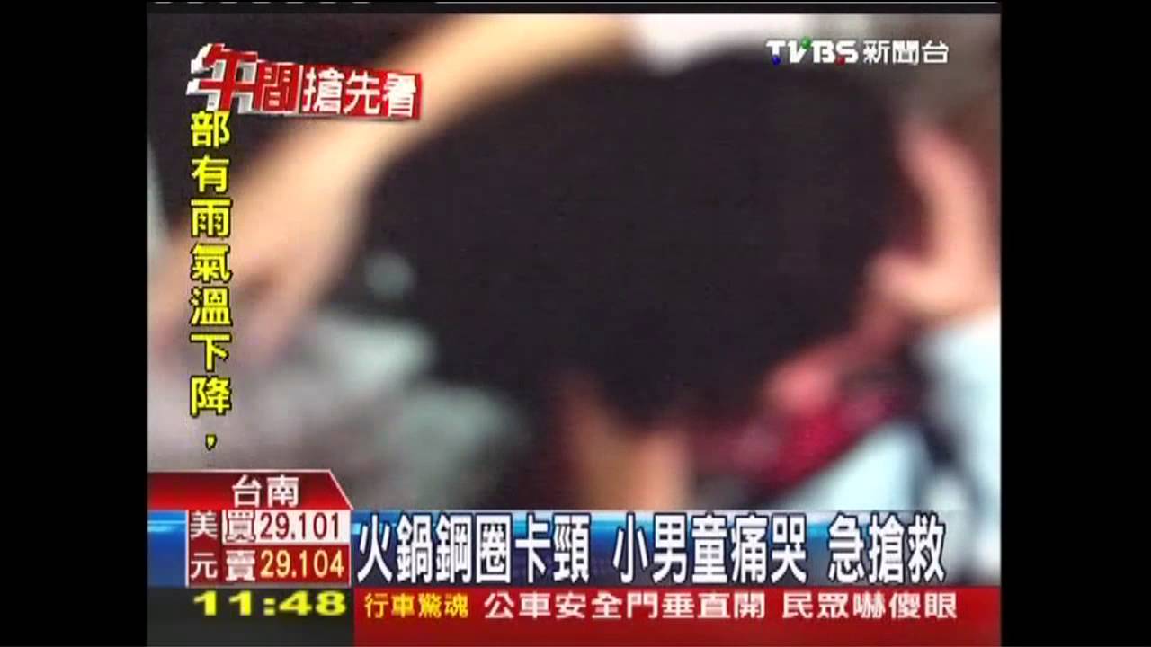 火鍋鋼圈卡頸！小男童痛哭　急搶救