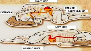 Esse  o porque voc deve dormir do seu lado esquerdo