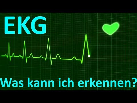 Arterielle Druckpuls 80 50 100 Fiziotenz und seine Wirkung
