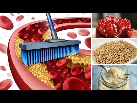 Die Schuppenflechte die äußerlichen Merkmale Die Plasmapherese hilft bei der Schuppenflechte
