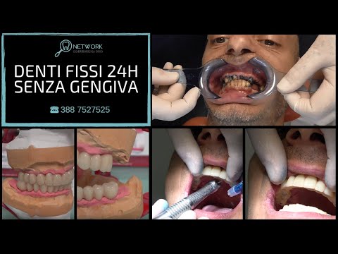 Dopo articolazioni angina crackle Complicazioni di artroscopia del ginocchio