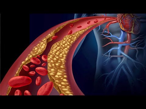 How to Measure and Lower Inflammation in Your Body