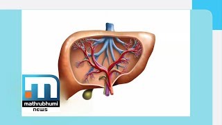 Liver Diseases Part-2