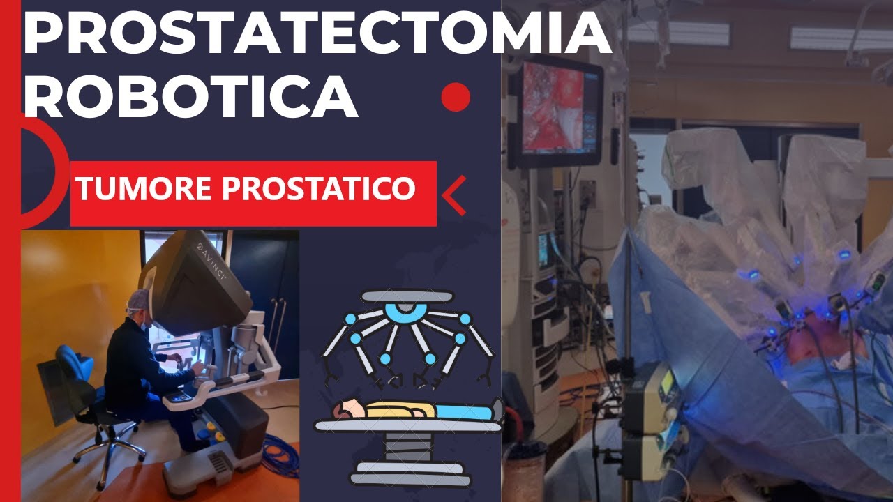 Pier Andrea Della Camera-22