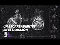 TENÍA Un ESCARBADIENTES En El CORAZÓN Cómo Sobrevivió Historias únicas En Telefe Noticias