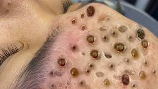 𝐑𝐞𝐟𝐫𝐞𝐬𝐡 𝐘𝐨𝐮𝐫 𝐅𝐚𝐜𝐞 𝐖𝐢𝐭𝐡 LNG 𝐒𝐤𝐢𝐧 𝐂𝐚𝐫𝐞 #