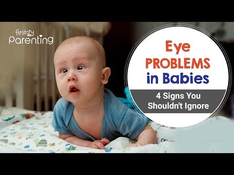 Common Eye Problems in Babies - Causes Symptoms and Treatment