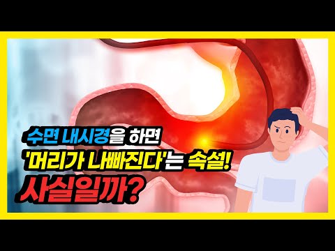 수면내시경에 대한 속설, 사실일까? 내시경 전 알아야 할 이야기!