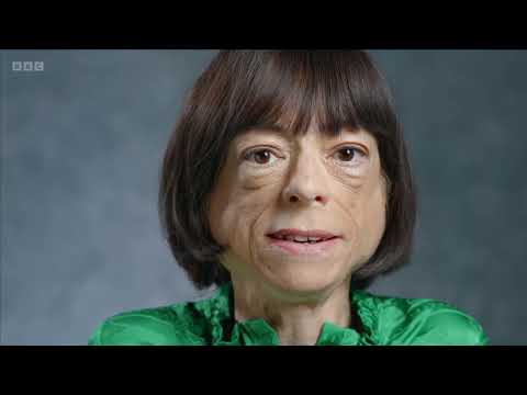 Better Off Dead? - Liz Carr's documentary on assisted suicide