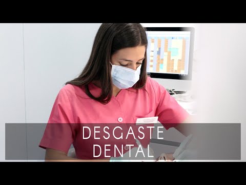 ¿Qué es el desgaste dental?