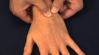 Nghiệm pháp Reagan