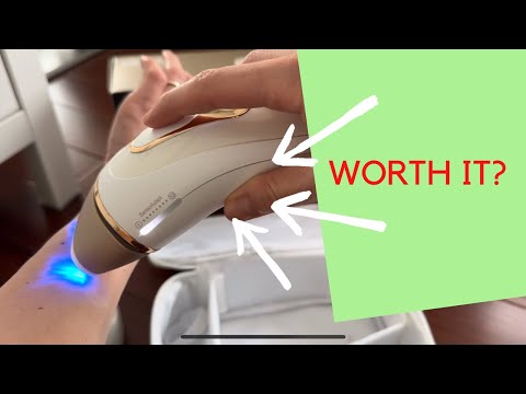 1 Year of Smooth Skin at Home? Honest Review of This IPL Hair Removal Device!