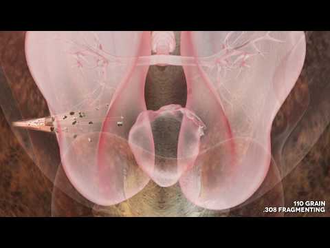 Lehigh Defense - The best .380 carry round?