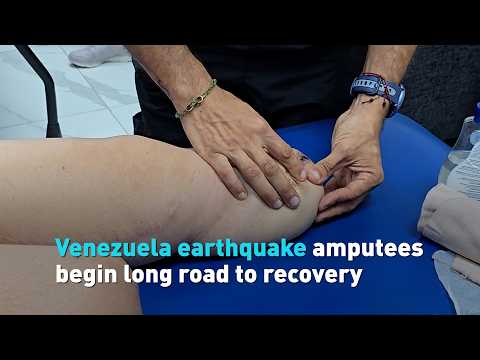 Venezuela earthquake amputees begin long road to recovery