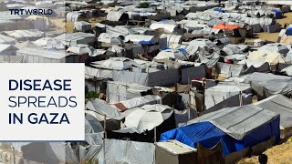 Video: 'Rats and rodents have made our lives Hell', survivors of Israeli genocide report | TRT World