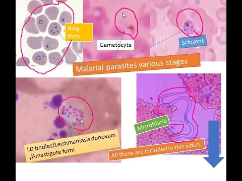 hemoparasites meghatározása