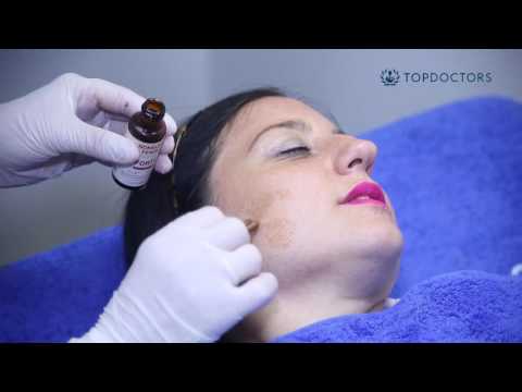 Skin spots - Treatments to remove skin spots