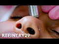 What Microdermabrasion Looks Like Up Close Macro Beauty Refinery29