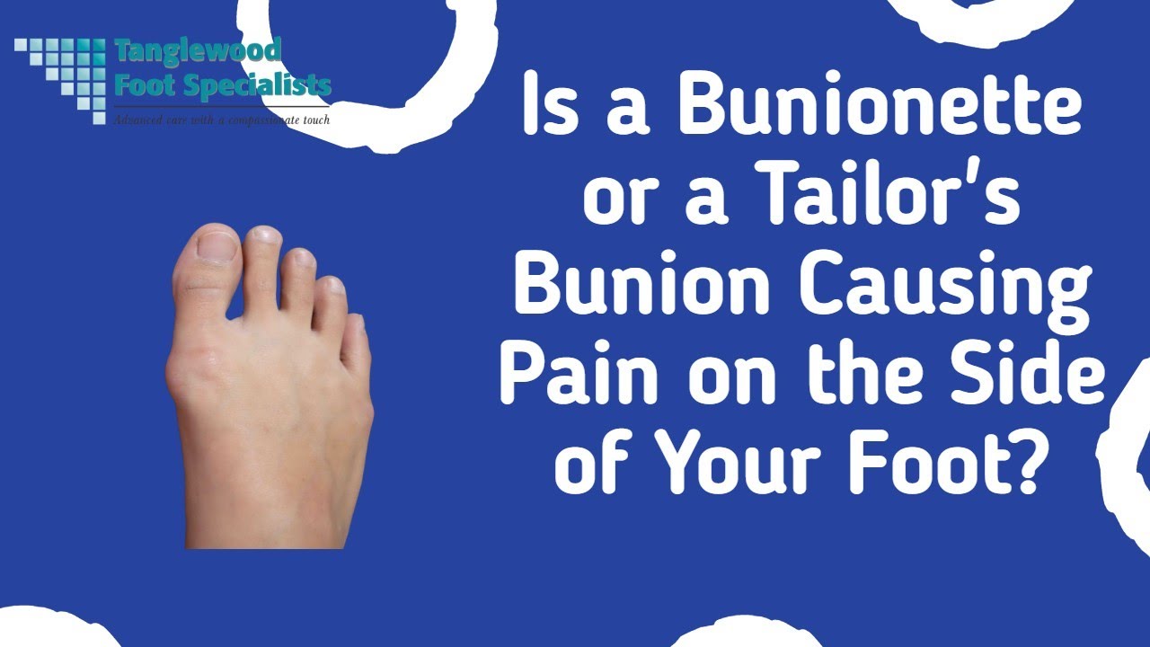 How do you do bunion surgery? Tanglewood Foot Specialists