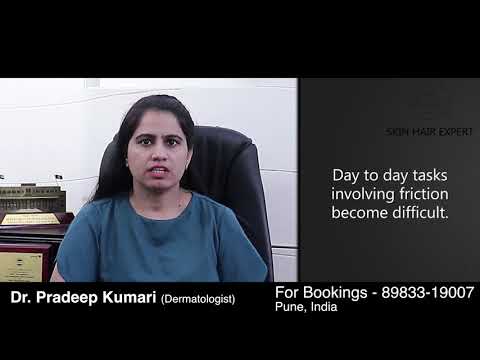 Skin Hair Expert | Pompholyx | Dr Pradeep Kumari