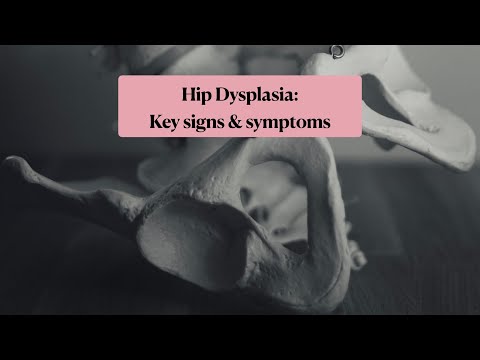 Hip dysplasia key signs and symptoms