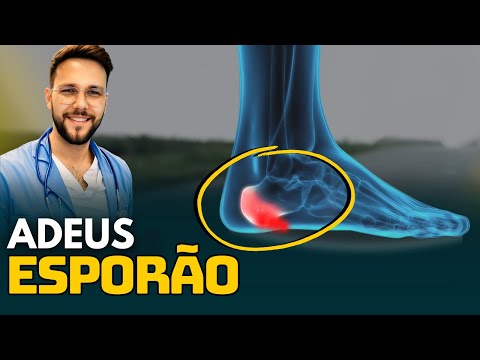 Heel Spurs: Home Treatment That Really Works