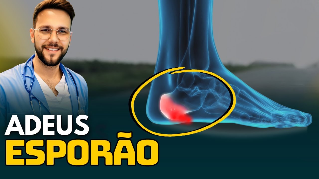 Heel Spurs: Home Treatment That Really Works
