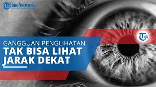 Rabun Dekat, Gangguan Penglihatan Sebabkan Penderita Tak Bisa Melihat Benda dalam Jarak Dekat