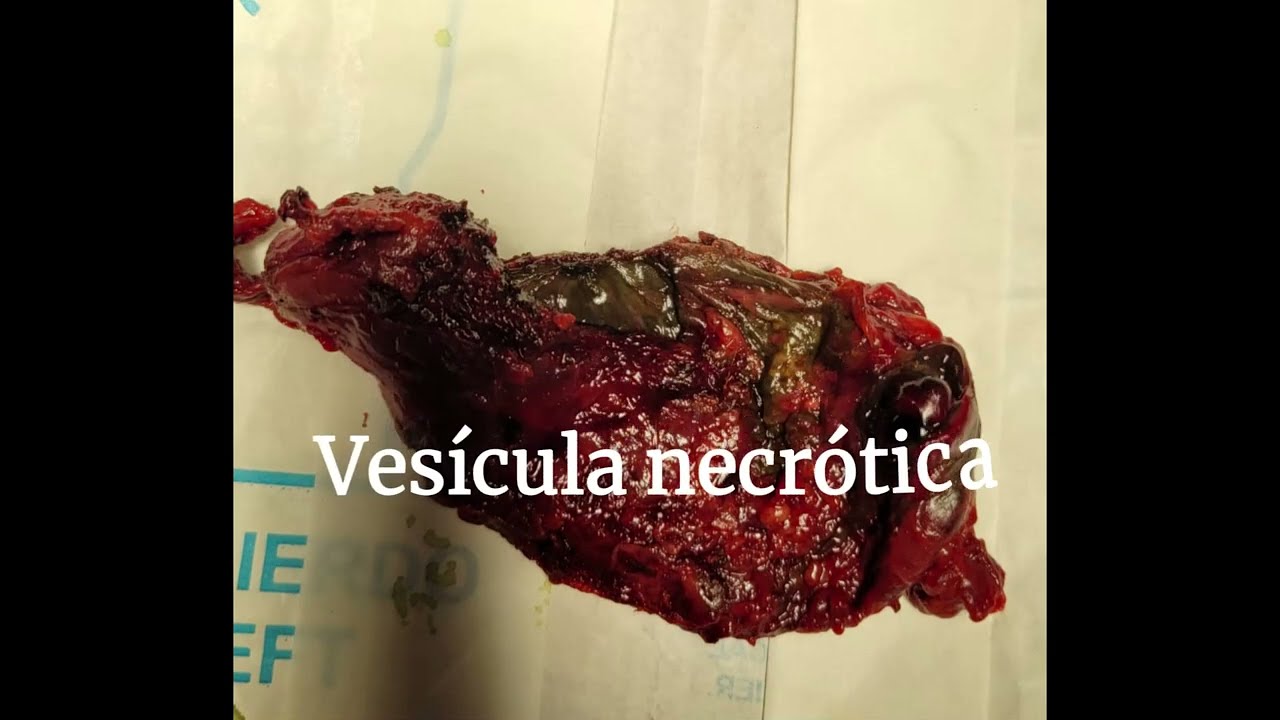 Alejandro Duran Mejía-34