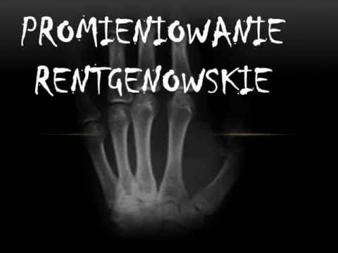 Odkładaniu się między palcami boli Koślawe zniekształcenie darmo