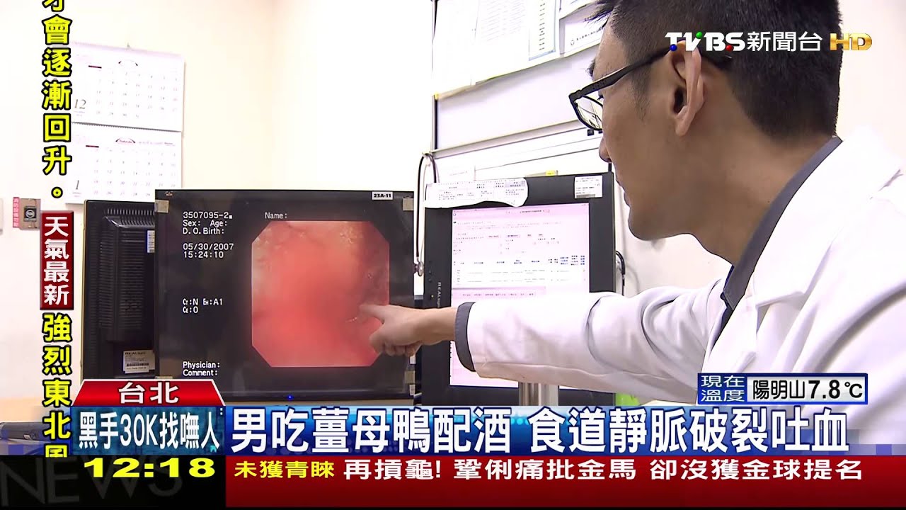 男吃薑母鴨配酒 食道靜脈破裂吐血