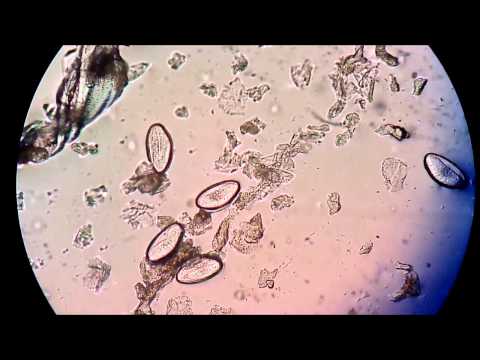 nyakplatyhelminthes reprodukció pinworms állandóan
