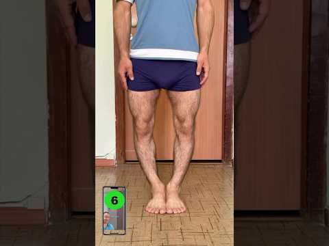 How To Fix BOW LEGS! 🤯