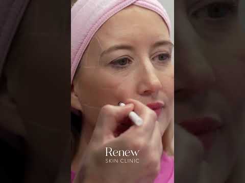Renew Skin Clinic