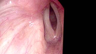 Basic Laryngology: Mind the Gap — Part 2