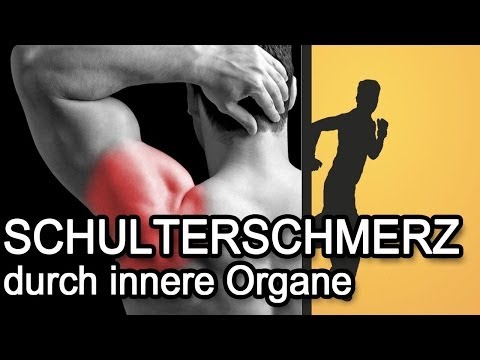 Schulterschmerzen durch innere Organe