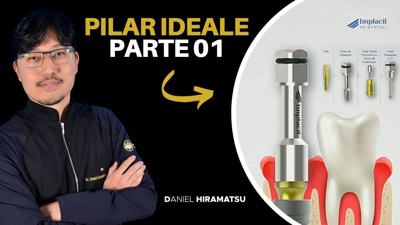 Pilar Ideale - Parte 01