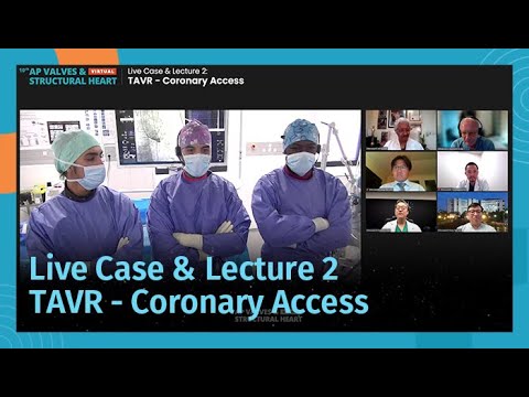 [AP VALVES & SH 2021] Live Case & Lecture 2: TAVR - Coronary Access