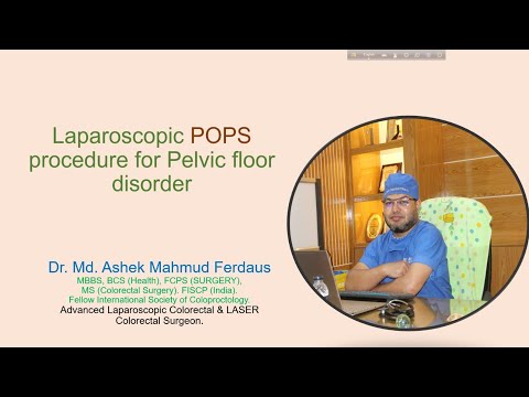 Laparoscopic POPS surgery