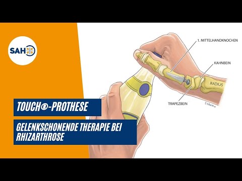 Die Touch®-Prothese