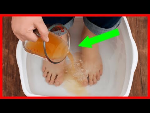 Flabby tiyan paano alisin Diyeta sa mawala timbang sa 10 kg bawat buwan, at ang mga resulta ng mga review