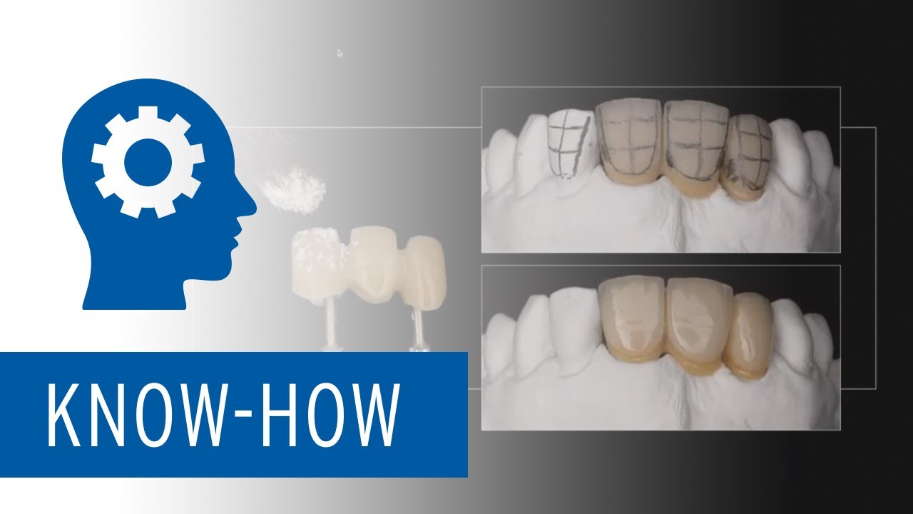 The measure of success