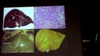 1_ Dr. Faisal  Cell Injury Fatty Change part 4