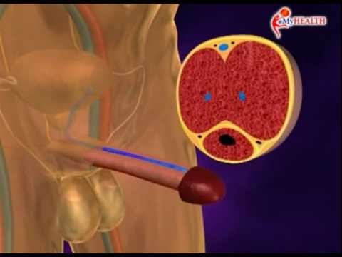 Apakah Itu Mati Pucuk? | Soalan &amp; Jawapan